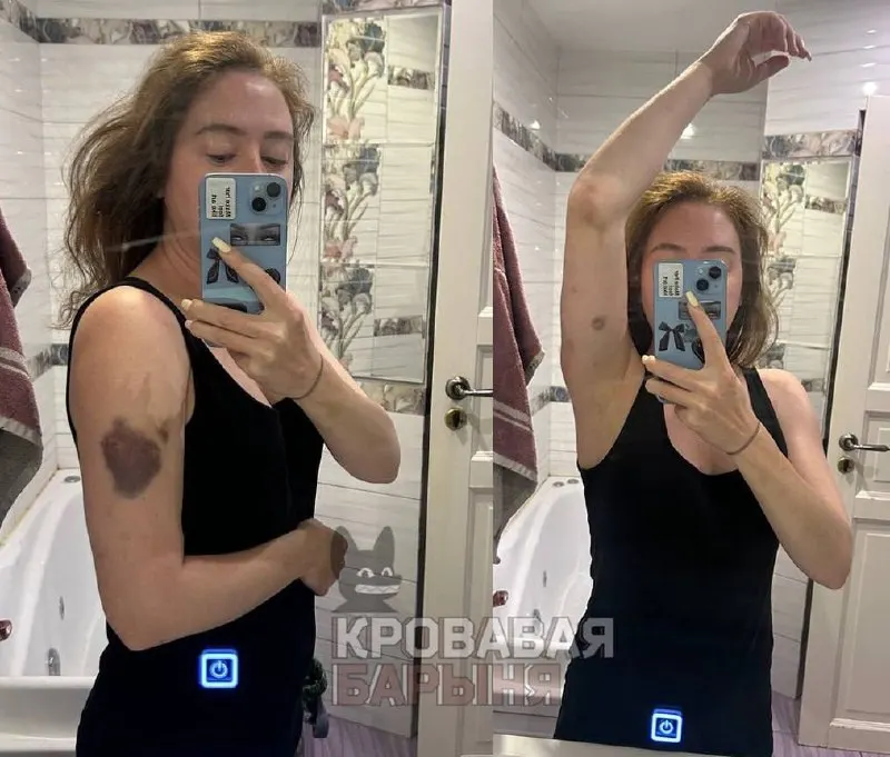 Жительница Омска рассказала, что годами подвергалась побоям и преследованию со стороны бывшего мужа — экс‑сотрудника полиции; по её словам, предыдущие жалобы не принесли результата.